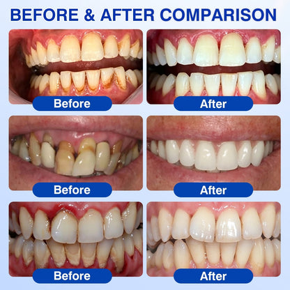 🦷 PERIVA Advanced Gum Care Gel — Targeted Daily Care for Fresher Breath & Healthier-Looking Gums