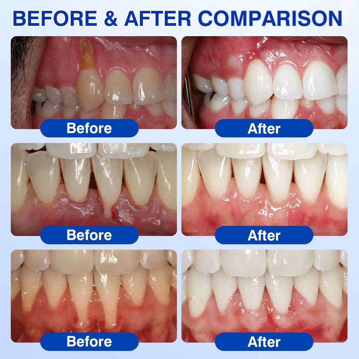 🦷 PERIVA Advanced Gum Care Gel — Targeted Daily Care for Fresher Breath & Healthier-Looking Gums