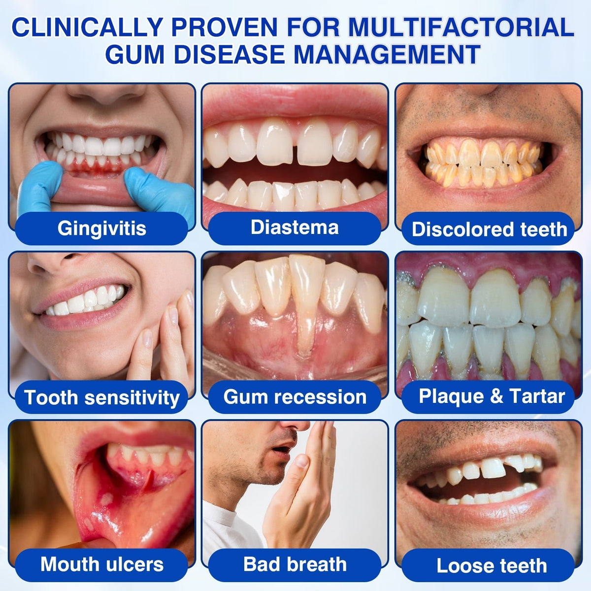 🦷 PERIVA Advanced Gum Care Gel — Targeted Daily Care for Fresher Breath & Healthier-Looking Gums