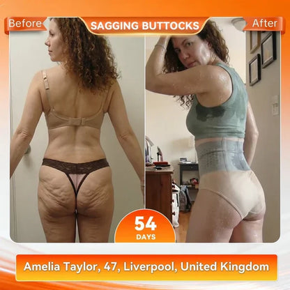 Last Day 50% OFF Moringa & Berberine 4‑In‑1 Micro‑Particle Sculpting & Fat‑Burn Shorts